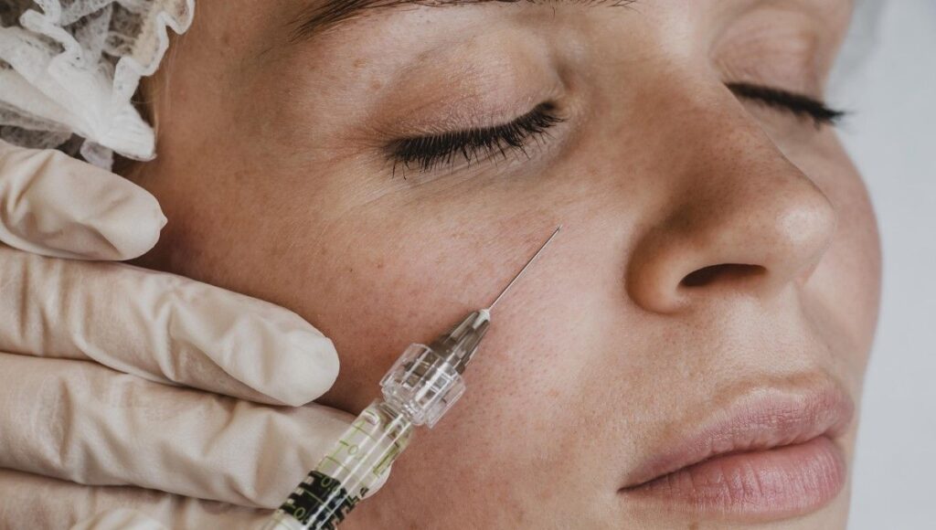 Bioestimuladores faciales