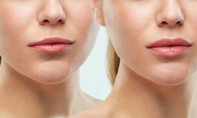 Aumento de Labios en Famosas: Descubre Sus Secretos y Técnicas